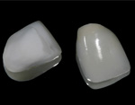 Veneers