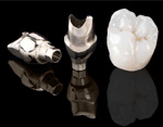 Implantate